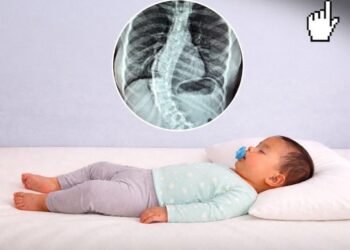 Zòrye pa pou tibebe : yon risk paran yo dwe konnen